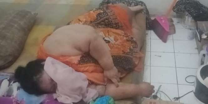 9 Potret Orang-Orang Obesitas yang Viral, Terakhir Paling Parah, Beberapa Sudah Meninggal Dunia!