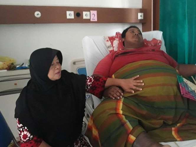 9 Potret Orang-Orang Obesitas yang Viral, Terakhir Paling Parah, Beberapa Sudah Meninggal Dunia!
