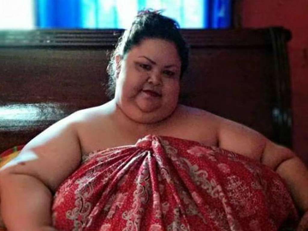 9 Potret Orang-Orang Obesitas yang Viral, Terakhir Paling Parah, Beberapa Sudah Meninggal Dunia!