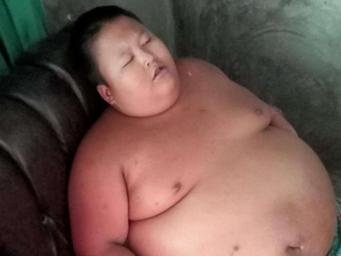 9 Potret Orang-Orang Obesitas yang Viral, Terakhir Paling Parah, Beberapa Sudah Meninggal Dunia!