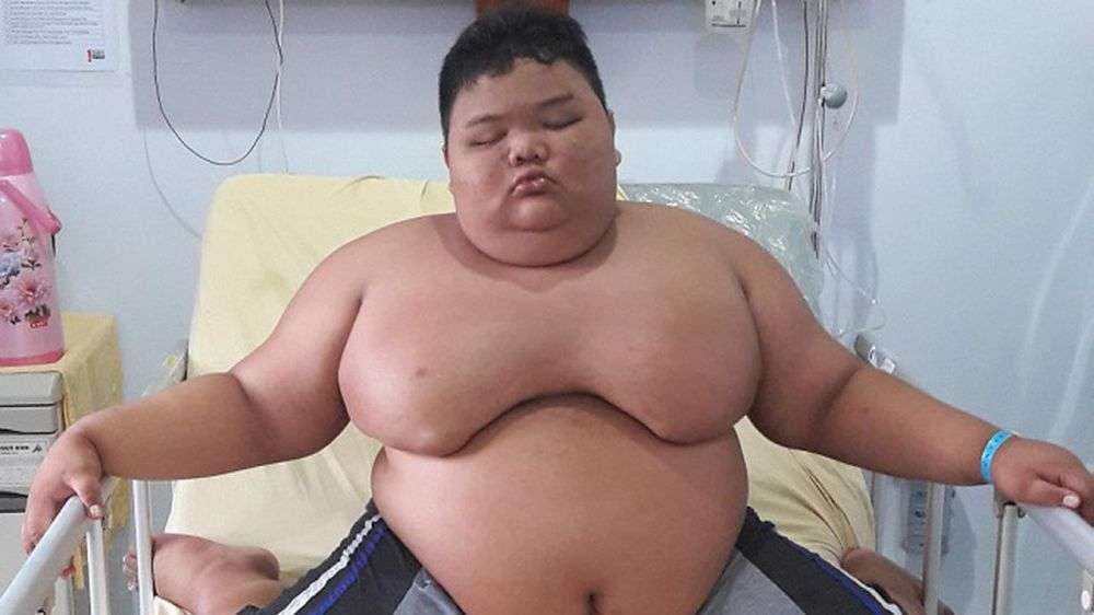 9 Potret Orang-Orang Obesitas yang Viral, Terakhir Paling Parah, Beberapa Sudah Meninggal Dunia!