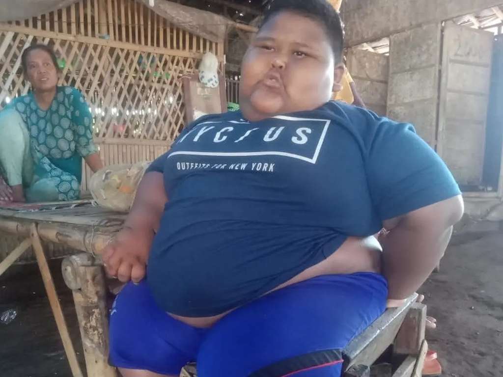 9 Potret Orang-Orang Obesitas yang Viral, Terakhir Paling Parah, Beberapa Sudah Meninggal Dunia!