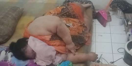 9 Potret Orang-Orang Obesitas yang Viral, Terakhir Paling Parah, Beberapa Sudah Meninggal Dunia!