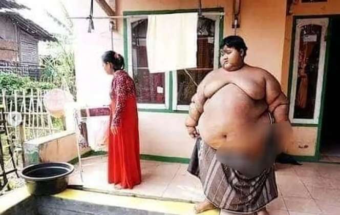 Masih Ingat Arya Permana Bocah Seberat 190 Kg? Dulu Sosoknya Viral Kini Penampilan Terbarunya Bikin Pangling, Netizen: `Kayak Beda Orang`