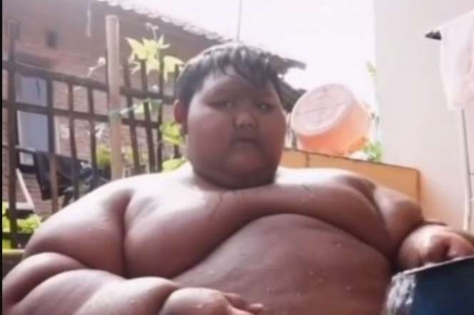 Masih Ingat Arya Permana Bocah Seberat 190 Kg? Dulu Sosoknya Viral Kini Penampilan Terbarunya Bikin Pangling, Netizen: `Kayak Beda Orang`