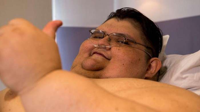 10 Potret Pria Terberat di Dunia Bobotnya 600 Kilogram, Kini Perubahannya Bikin Melongo!