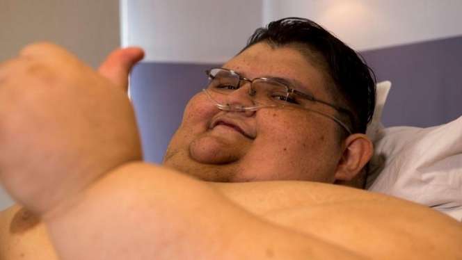 10 Potret Pria Terberat di Dunia Bobotnya 600 Kilogram, Kini Perubahannya Bikin Melongo!