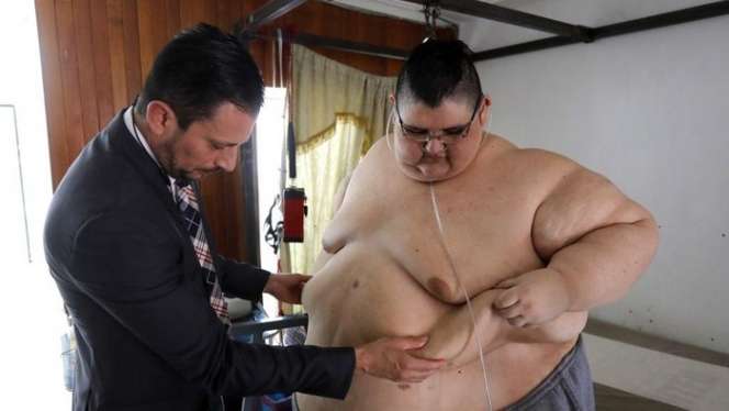10 Potret Pria Terberat di Dunia Bobotnya 600 Kilogram, Kini Perubahannya Bikin Melongo!