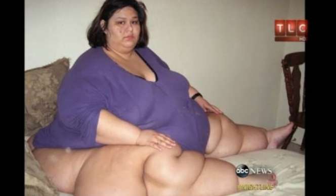 Wanita Berbobot 480 Kg Viral Usai Akui Tindih Keponakan Hingga Meninggal, Ternyata Ada Fakta Mengejutkan, Kini Penampilannya Bikin Pangling!