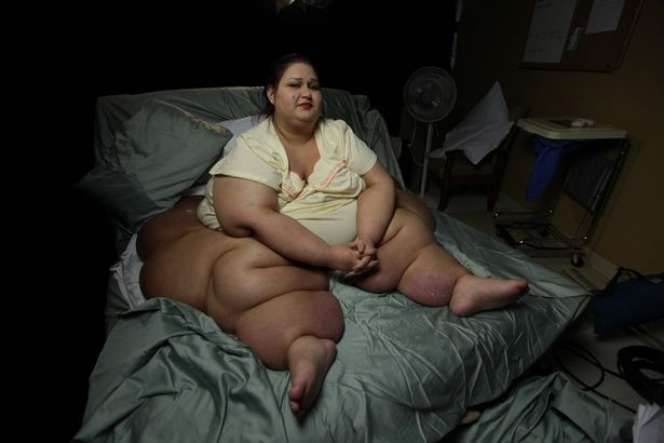 Wanita Berbobot 480 Kg Viral Usai Akui Tindih Keponakan Hingga Meninggal, Ternyata Ada Fakta Mengejutkan, Kini Penampilannya Bikin Pangling!