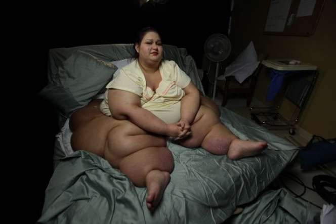 Wanita Berbobot 480 Kg Viral Usai Akui Tindih Keponakan Hingga Meninggal, Ternyata Ada Fakta Mengejutkan, Kini Penampilannya Bikin Pangling!