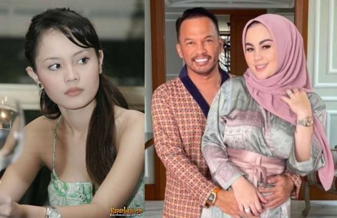 Potret Dulu VS Kini Artis Jalani Operasi Potong Lambung, Terbaru Jennifer Dunn Bikin Pangling!