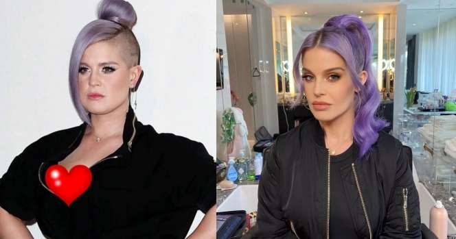 Potret Dulu VS Kini Artis Jalani Operasi Potong Lambung, Terbaru Jennifer Dunn Bikin Pangling!