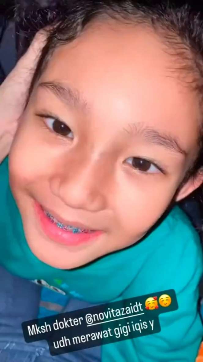 Potret Senyum Manis Bilqis Anak Ayu Ting Ting yang Kini Pakai Kawat Gigi 