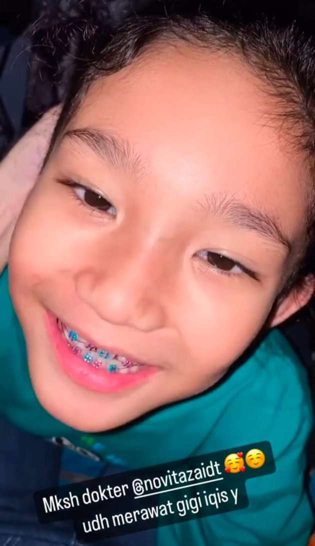 Potret Senyum Manis Bilqis Anak Ayu Ting Ting yang Kini Pakai Kawat Gigi 