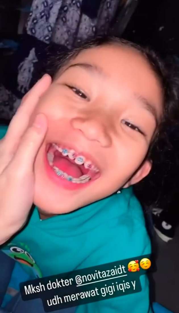 Potret Senyum Manis Bilqis Anak Ayu Ting Ting yang Kini Pakai Kawat Gigi 