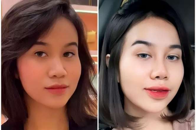 10 Artis Sebelum VS Sesudah Operasi Plastik, Denada Berubah Banget, Makin Mirip Barbie Hidup!