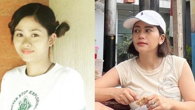 10 Artis Sebelum VS Sesudah Operasi Plastik, Denada Berubah Banget, Makin Mirip Barbie Hidup!