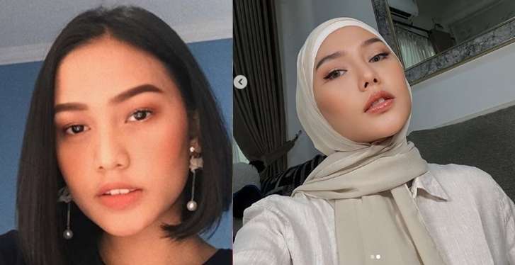 10 Artis Sebelum VS Sesudah Operasi Plastik, Denada Berubah Banget, Makin Mirip Barbie Hidup!