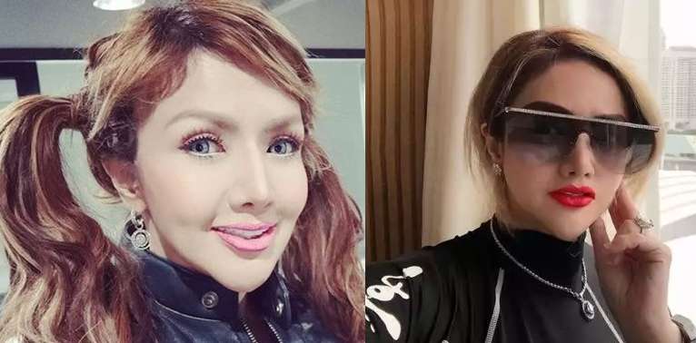 10 Artis Sebelum VS Sesudah Operasi Plastik, Denada Berubah Banget, Makin Mirip Barbie Hidup!