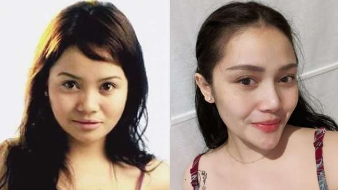 10 Artis Sebelum VS Sesudah Operasi Plastik, Denada Berubah Banget, Makin Mirip Barbie Hidup!