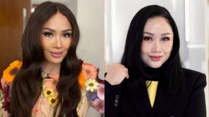 10 Artis Sebelum VS Sesudah Operasi Plastik, Denada Berubah Banget, Makin Mirip Barbie Hidup!
