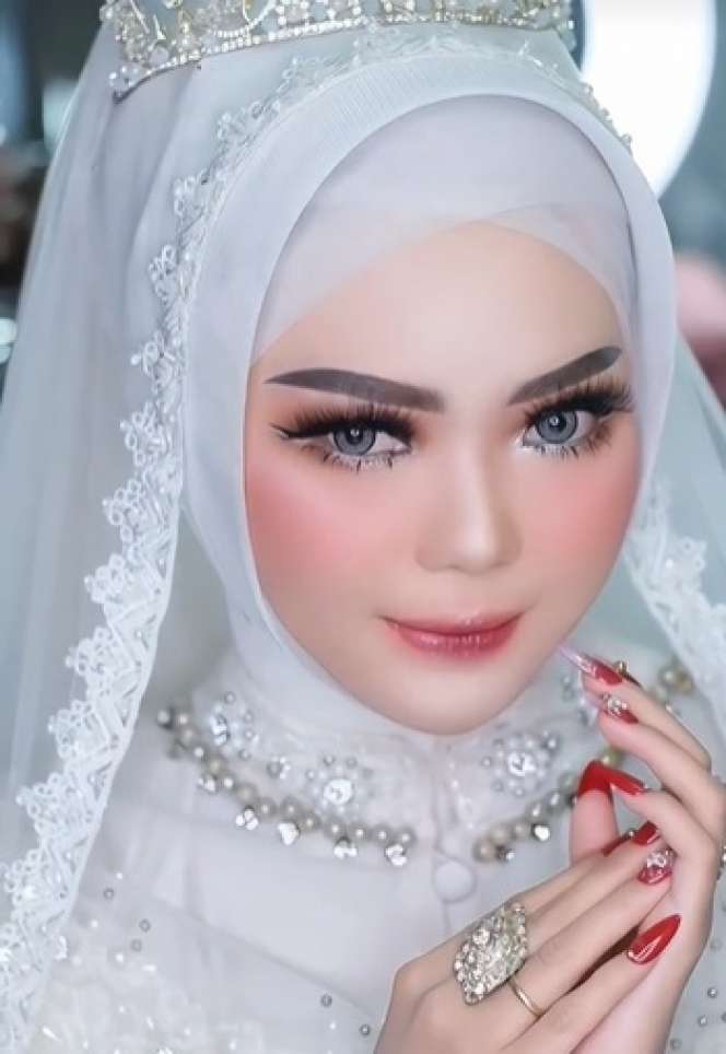 Wajah Pengantin Penuh Jerawat Ini Seketika Berubah Drastis Usai Dirias MUA, Ternyata Begini Hasilnya…