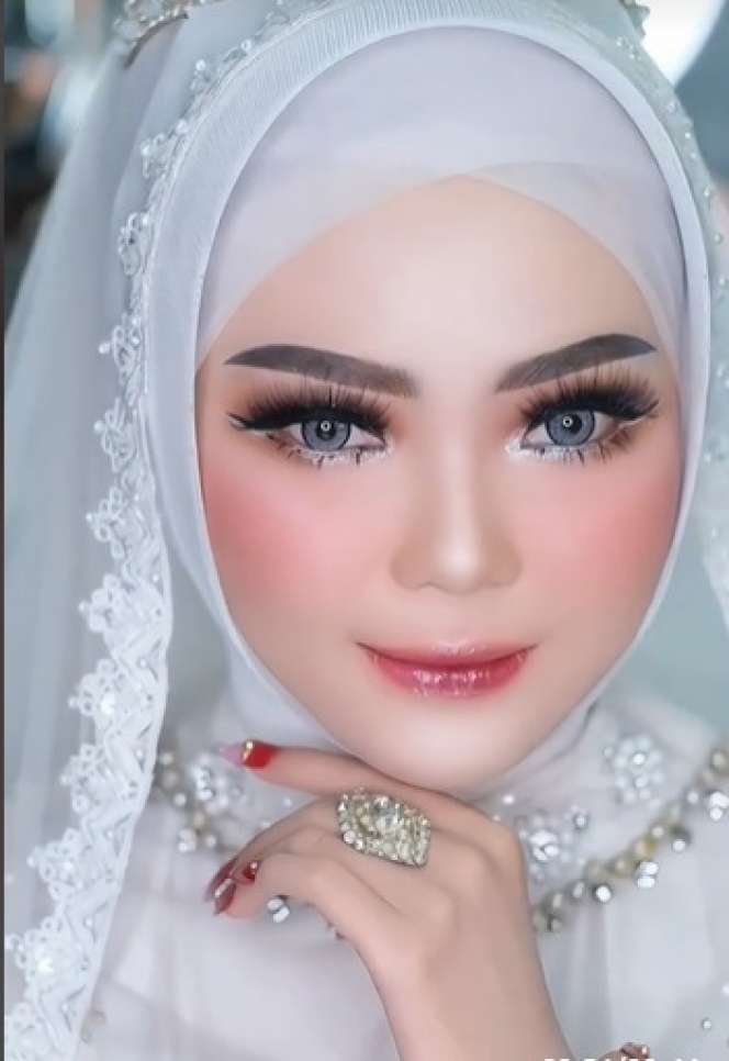 Wajah Pengantin Penuh Jerawat Ini Seketika Berubah Drastis Usai Dirias MUA, Ternyata Begini Hasilnya…