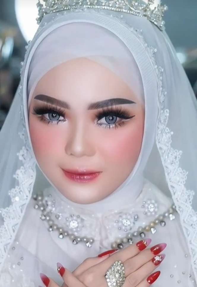 Wajah Pengantin Penuh Jerawat Ini Seketika Berubah Drastis Usai Dirias MUA, Ternyata Begini Hasilnya…