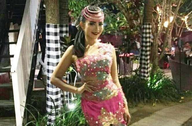 Potret Before After Bella Bonita Sebelum dan Sesudah Terkenal