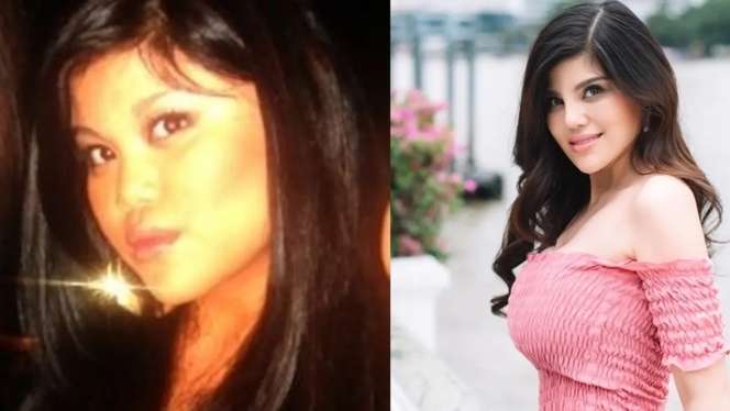 Wajah Berubah Total! 10 Artis ini Dituding Oplas, Foto SMA Bella Bonita Jadi Gunjingan!