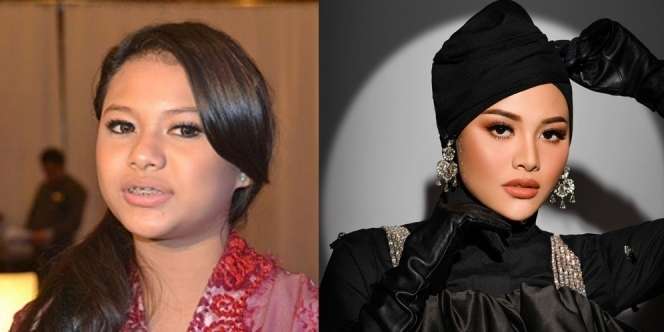 Wajah Berubah Total! 10 Artis ini Dituding Oplas, Foto SMA Bella Bonita Jadi Gunjingan!