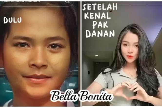 Wajah Berubah Total! 10 Artis ini Dituding Oplas, Foto SMA Bella Bonita Jadi Gunjingan!