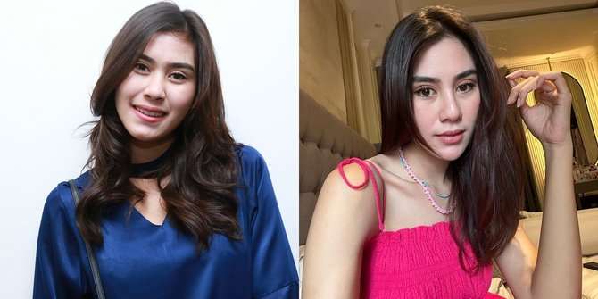 Wajah Berubah Total! 10 Artis ini Dituding Oplas, Foto SMA Bella Bonita Jadi Gunjingan!