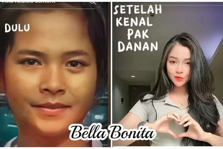 Wajah Berubah Total! 10 Artis ini Dituding Oplas, Foto SMA Bella Bonita Jadi Gunjingan!