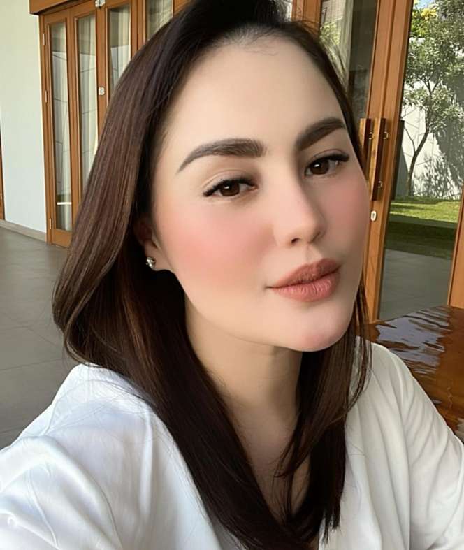 Potret Terbaru Jennifer Dunn Pasca Operasi Potong Lambung, Makin Kurus!