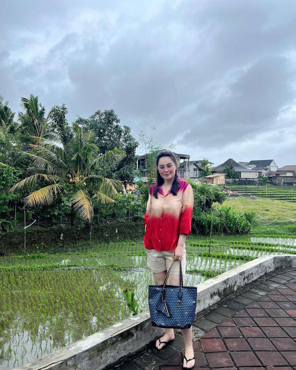 Potret Terbaru Jennifer Dunn Pasca Operasi Potong Lambung, Makin Kurus!