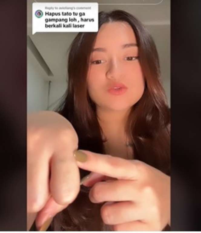 Perjuangan Nathalie Holscher Hapus Tato di Tubuhnya, Sakitnya Minta Ampun!