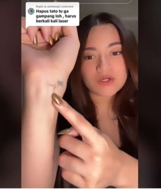 Perjuangan Nathalie Holscher Hapus Tato di Tubuhnya, Sakitnya Minta Ampun!