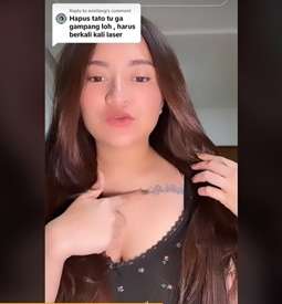 Perjuangan Nathalie Holscher Hapus Tato di Tubuhnya, Sakitnya Minta Ampun!