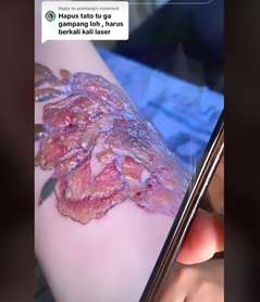 Perjuangan Nathalie Holscher Hapus Tato di Tubuhnya, Sakitnya Minta Ampun!
