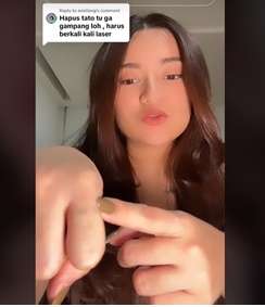 Perjuangan Nathalie Holscher Hapus Tato di Tubuhnya, Sakitnya Minta Ampun!