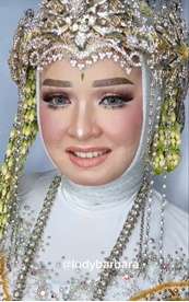 Wajah Beruntusan Parah, Pengantin Sunda Ini Bisa Tampil Memesona di Hari Pernikahan Berkat Tangan Ajaib MUA, Hasilnya Bikin Pangling!