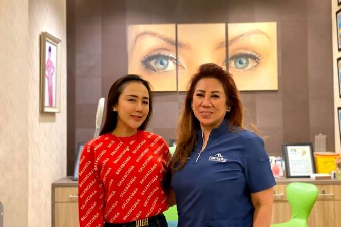 Sederet Artis yang Pernah Jalani Transplantasi Rambut, Ada yang Ditusuk Jarum Ribuan Kali