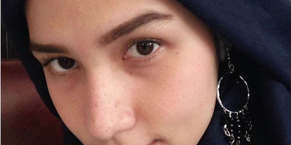Solusi Atasi Noda Bekas Jerawat