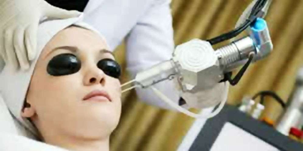 Hukum Laser Wajah Penghilang Jerawat