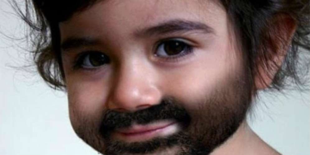 Kasian, Bayi Berumur Setahun Ini Alami Pubertas Lebih Cepat
