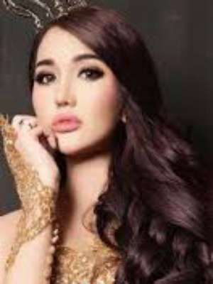 Dituding Transgender, Lucinta Luna Dapat Dukungan Mike Lewis