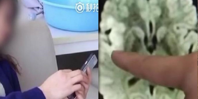Menatap Layar Ponsel 20 Jam NonStop, Darah Di Otak Membeku