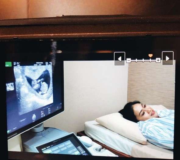 Rini Yulianti